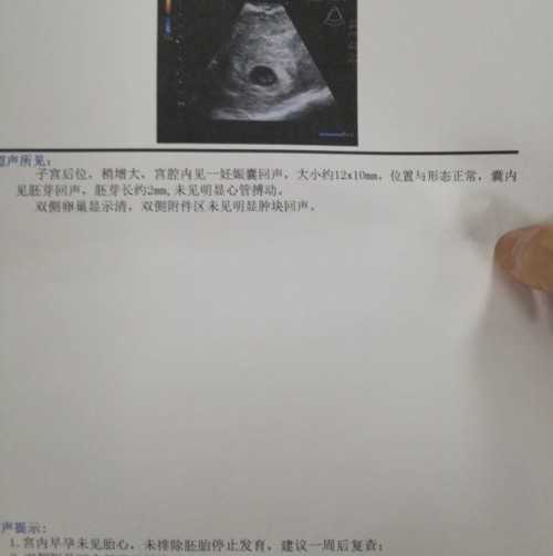 上海试管代生案例,上海第三代试管婴儿生男孩，