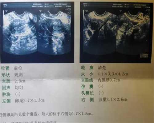 上海代生宝宝包成功,上海三代试管医院哪家最好？可以脱染吗？