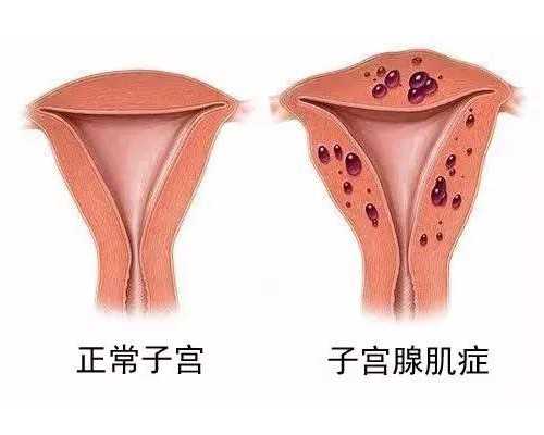 上海供卵代生儿子,上海三代试管公司，咨询南方39助孕了解试管移植