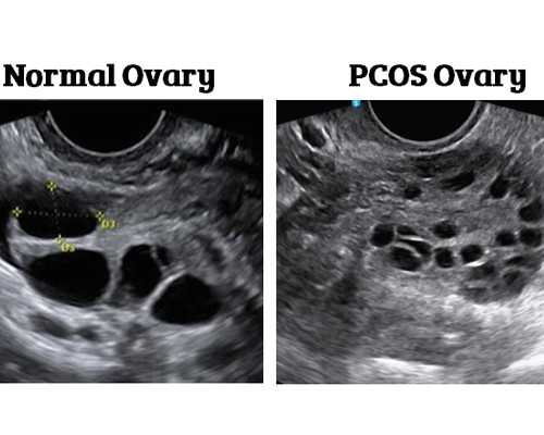 上海国内四代试管,上海三代试管婴儿包生儿子费用多少