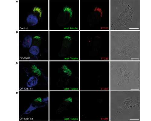 上海哪里供卵试管婴儿, 上海仁济北院试管『夜针』
