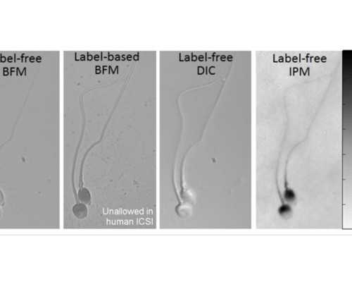 上海供卵自怀,北京供卵公司博诺（上海世纪供卵试管公司）-上海供卵试管婴儿