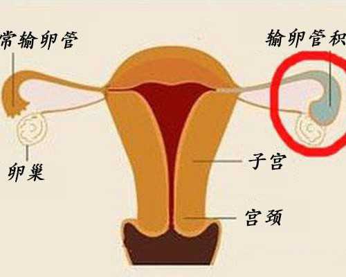 上海代孕生子网,上海一妇婴三代试管能生男孩吗？附详细试管费用