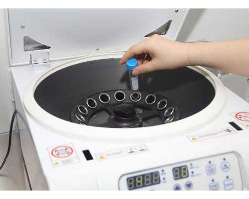 无精子症的几种原因