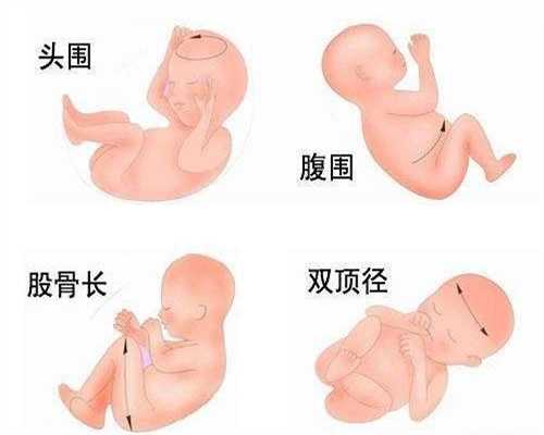 怎样减轻早孕反应_代孕宝宝的血型