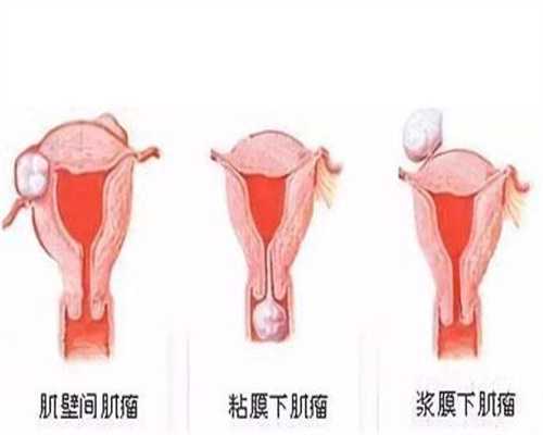 上海代孕前检查多少钱_上海供卵包代孕包生男孩_代孕产子的费用_找代怀孕机构