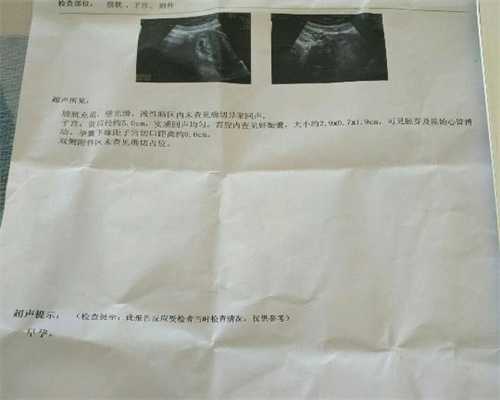 上海代孕的流程是怎样的_上海代孕生孩子包性别_怀孕会使皮肤发生过敏？