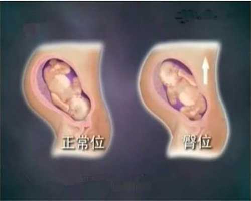公立医院供卵要等多久_上海有哪家医院可以供卵_谁知道到底先天性无精症能＊