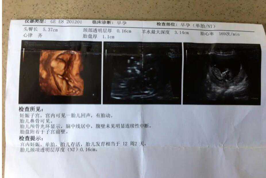 上海代怀孕的成功率-上海代怀医院的流程